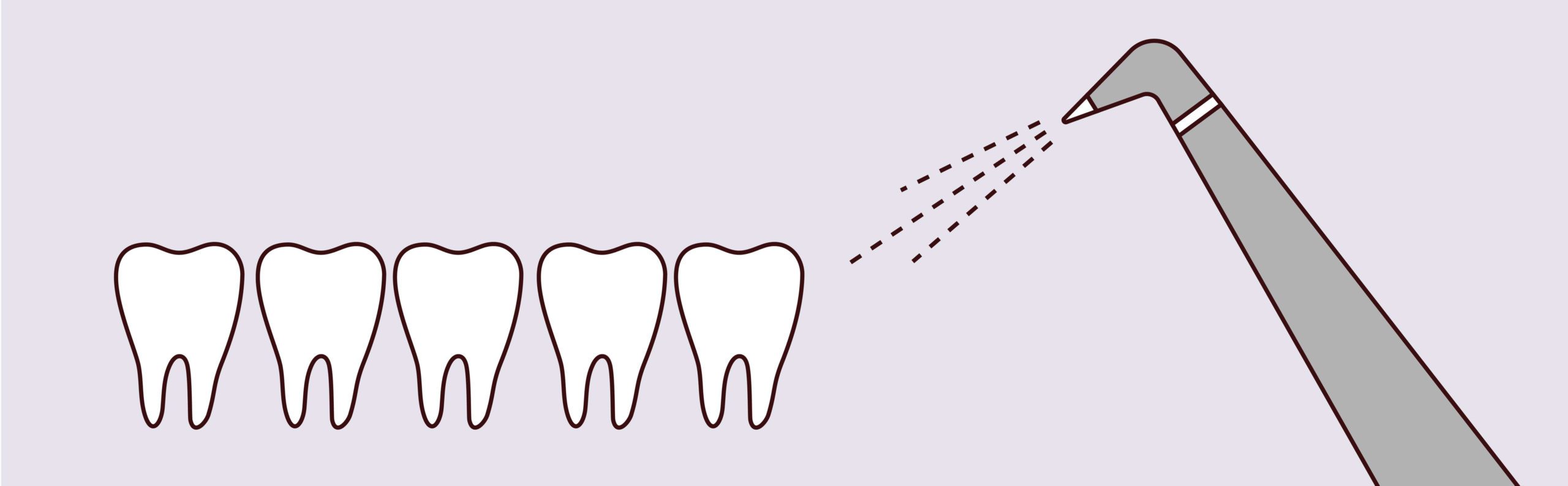 Yerra Family Dentistry - Woodinville Dentist Yerra Family Dentistry - Woodinville Dentist