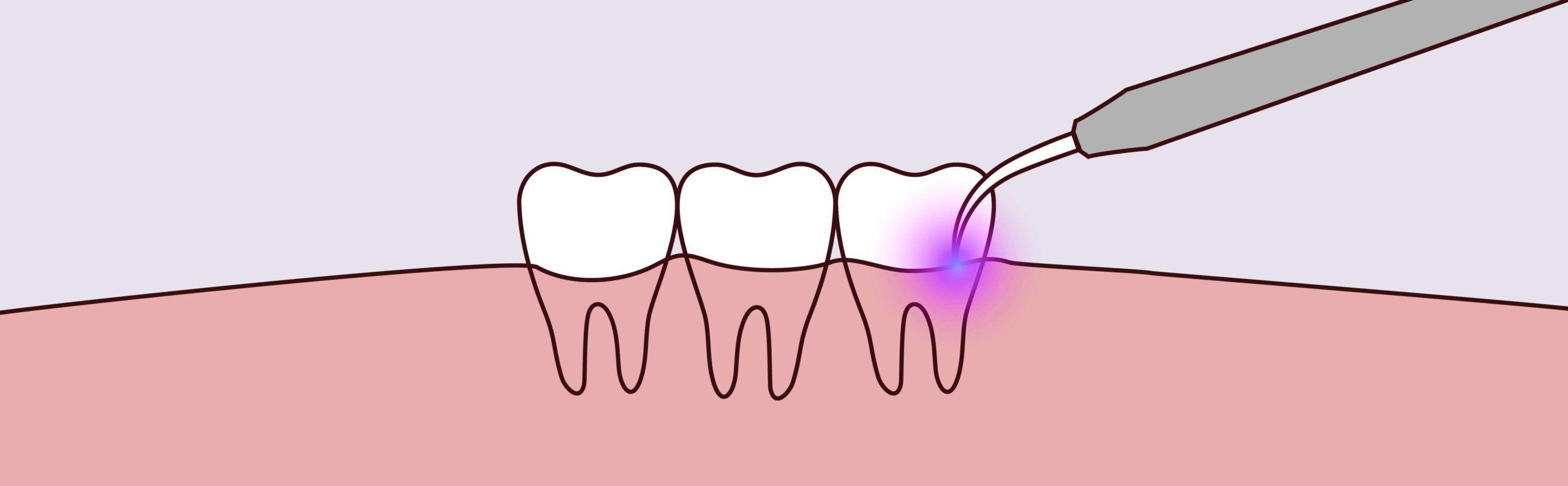 Yerra Family Dentistry - Woodinville Dentist Yerra Family Dentistry - Woodinville Dentist