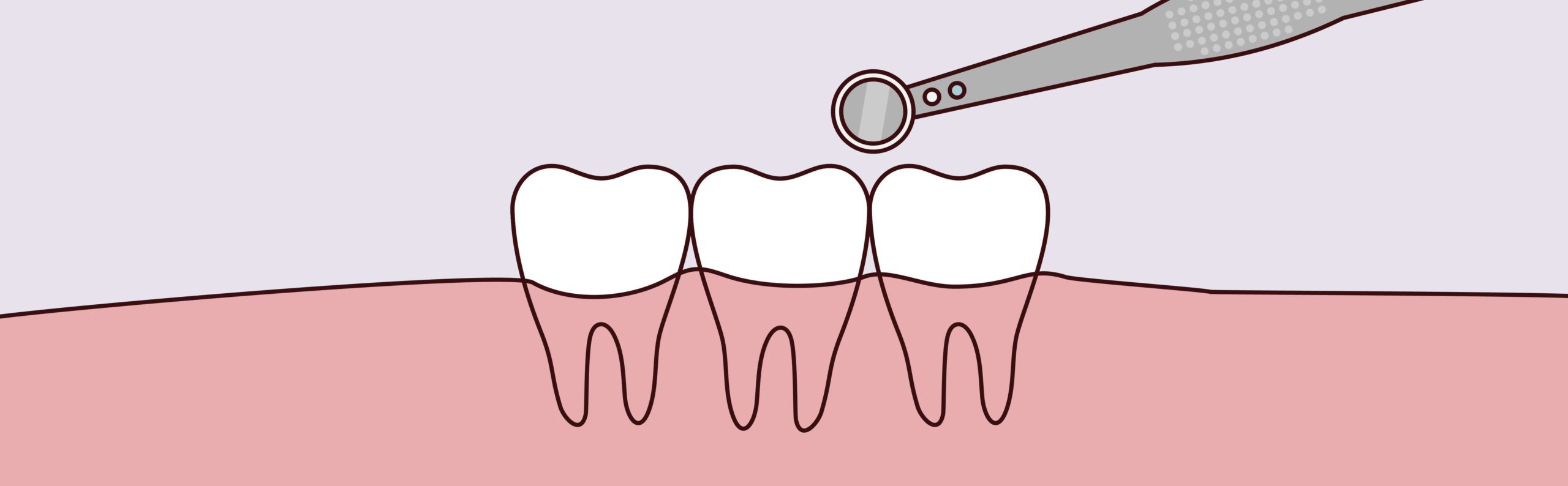 Yerra Family Dentistry - Woodinville Dentist Yerra Family Dentistry - Woodinville Dentist