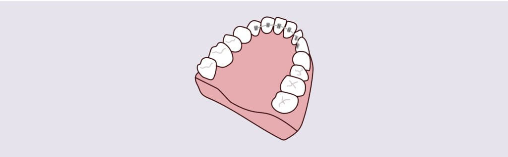 Yerra Family Dentistry - Woodinville Dentist Yerra Family Dentistry - Woodinville Dentist