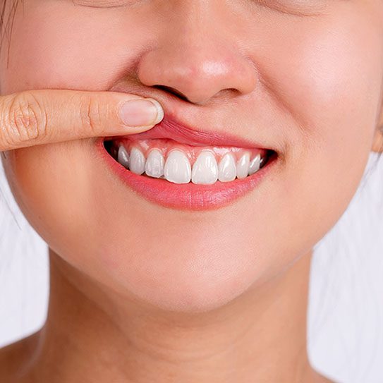 Yerra Family Dentistry - Woodinville Dentist