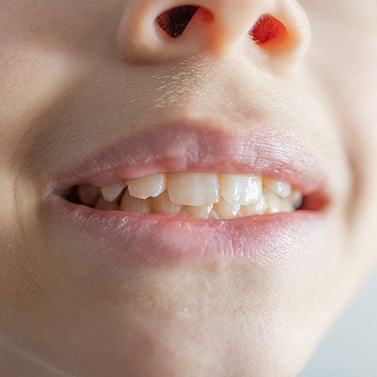 Yerra Family Dentistry - Woodinville Dentist